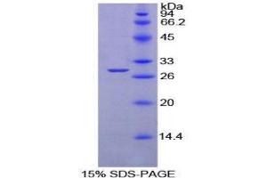 SDS-PAGE (SDS) image for Protein tyrosine Phosphatase, Receptor Type, S (PTPRS) (AA 889-1102) protein (His tag) (ABIN1879561)