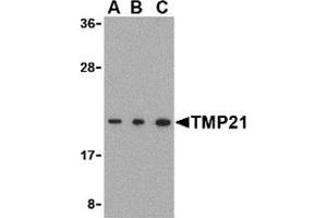 Western blot analysis of TMP21 in Raji cell lysate with this product at (A) 0. (TMED10 antibody  (C-Term))
