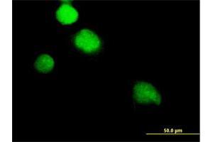 Immunofluorescence of purified MaxPab antibody to NEK2 on HeLa cell. (NEK2 antibody  (AA 1-445))