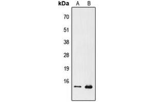 Western blot analysis of PFDN1 expression in Jurkat (A), Raw264. (PFDN1 antibody  (N-Term))