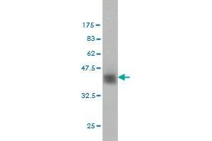 Western Blot detection against Immunogen (37. (ZNF41 antibody  (AA 221-321))