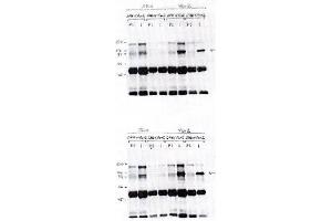HEK293 cells were transfected with either emply expression vector (pSRα) or pSRa-  Vav2 driving expression of human Vav2. (VAV2 antibody  (AA 612-691))