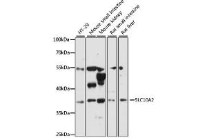 Western blot analysis of extracts of various cell lines, using SLC10A2 antibody (ABIN6292276) at 1:3000 dilution. (SLC10A2 antibody)