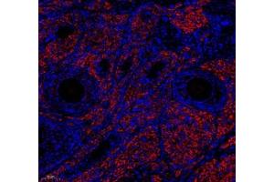 Immunofluorescence of paraffin embedded rat ovary using EMCN (ABIN7073818) at dilution of 1: 600 (180x lens) (Endomucin antibody)