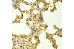 Immunohistochemistry of paraffin-embedded rat lung using TRADD antibody at dilution of 1:100 (x400 lens).
