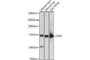 Western blot analysis of extracts of various cell lines, using NNT antibody (ABIN1681070, ABIN3019052, ABIN3019053 and ABIN6220687) at 1:3000 dilution. (NNT antibody  (AA 881-1086))