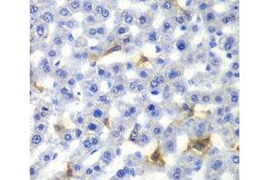 Immunohistochemistry of paraffin-embedded Rat liver using NR0B2 Polyclonal Antibody at dilution of 1:100 (40x lens).