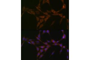 Immunofluorescence analysis of NIH-3T3 cells using 15-PGDH/HPGD Rabbit mAb (ABIN7267807) at dilution of 1:100 (40x lens). (HPGD antibody)