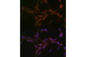 Immunofluorescence analysis of NIH-3T3 cells using 15-PGDH/HPGD Rabbit mAb (ABIN7267807) at dilution of 1:100 (40x lens). (HPGD antibody)