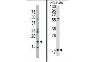 Image no. 1 for anti-Nucleoside diphosphate kinase B (NME2) (N-Term) antibody (ABIN360545) (NME2 antibody  (N-Term))
