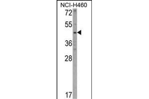 Western blot analysis of KYNU Antibody (C-term) (ABIN390735 and ABIN2841003) in NCI- cell line lysates (35 μg/lane). (KYNU antibody  (C-Term))