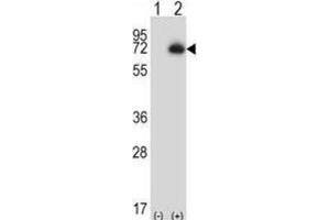 Western Blotting (WB) image for anti-Carboxypeptidase N Subunit 2 (CPN2) antibody (ABIN2997205) (CPN2 antibody)