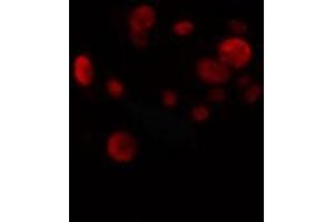 ABIN6274270 staining HuvEc cells by IF/ICC.