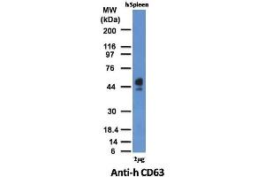 Western Blotting (WB) image for anti-CD63 (CD63) antibody (ABIN6941230)