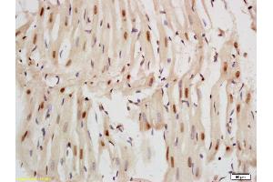 Formalin-fixed and paraffin embedded rat heart labeled with Anti-Nkx2. (Nkx2.5/ Cardiac-Specic Homeobox 1 (AA 85-180) antibody)