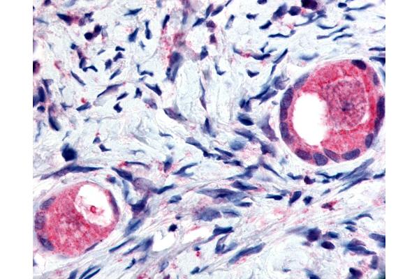 TMEM5 antibody  (Extracellular Domain)