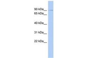 Image no. 1 for anti-Zinc Finger Protein 510 (ZNF510) (AA 107-156) antibody (ABIN6742620) (ZNF510 antibody  (AA 107-156))