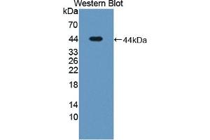 Detection of Recombinant LTBP1, Human using Polyclonal Antibody to Latent Transforming Growth Factor Beta Binding Protein 1 (LTBP1)