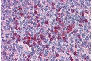 Human Tonsil: Formalin-Fixed, Paraffin-Embedded (FFPE) (ROBO2 antibody  (AA 252-301))