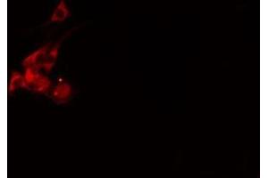 ABIN6275517 staining  NIH-3T3 cells by IF/ICC. (SCAMP1 antibody  (N-Term))