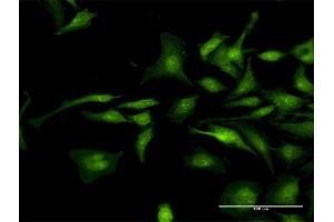Immunofluorescence of purified MaxPab antibody to CTNND1 on HeLa cell. (CTNND1 antibody  (AA 1-610))
