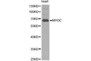 Western Blotting (WB) image for anti-Myocilin (MYOC) (AA 245-504) antibody (ABIN3022197) (MYOC antibody  (AA 245-504))