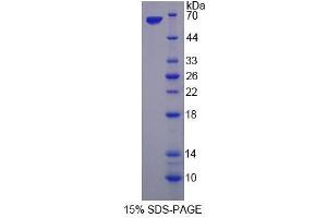 Image no. 1 for serine threonine Kinase 39 (STK39) (AA 63-545) protein (His tag) (ABIN4991023)