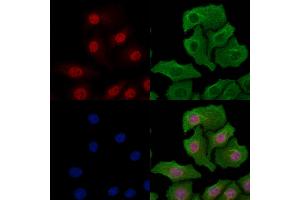 ABIN6257462 and ABIN6274283 staining Hela cells by IF/ICC.