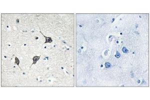 Immunohistochemistry analysis of paraffin-embedded human brain tissue using GPR20 antibody. (GPR20 antibody  (C-Term))
