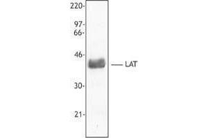 Western Blotting (WB) image for anti-Linker For Activation of T Cells (LAT) antibody (ABIN2666080) (LAT antibody)