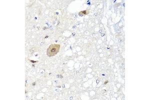 Immunohistochemistry of paraffin-embedded rat brain using FGF13 antibody at dilution of 1:100 (x40 lens).
