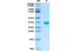 SARS-Cov-2 Spike RBD (Omicron BA. (SARS-CoV-2 Spike Protein (BA.2 - Omicron, RBD) (His tag))