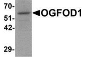 Western blot analysis of OGFOD1 in Daudi cell lysate with OGFOD1 antibody at 1 μg/ml. (OGFOD1 antibody  (C-Term))