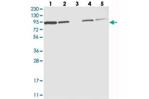Western blot analysis of Lane 1: RT-4, Lane 2: U-251 MG, Lane 3: Human Plasma, Lane 4: Liver, Lane 5: Tonsil with EFR3A polyclonal antibody  at 1:250-1:500 dilution. (EFR3A antibody)