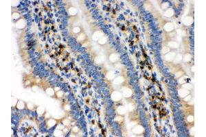 Immunohistochemistry (IHC) image for anti-Isocitrate Dehydrogenase 2 (NADP+), Mitochondrial (IDH2) (AA 413-447), (C-Term) antibody (ABIN3043856)