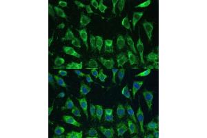 Immunofluorescence analysis of L-929 cells using Galectin 3/Galectin 3/LG antibody (ABIN6130437, ABIN6143158, ABIN6143159 and ABIN7101422) at dilution of 1:100. (Galectin 3 antibody  (AA 1-250))