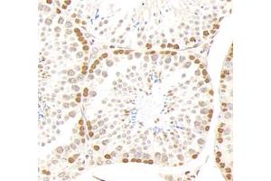 Immunohistochemistry analysis of paraffin-embedded mouse testis using,GSTT1 (ABIN7074091) at dilution of 1: 2000 (GSTT1 antibody)