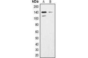 Western blot analysis of SHIP2 expression in K562 (A), Hela (B) whole cell lysates.