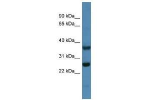 Western Blot showing Atp5f1 antibody used at a concentration of 1-2 ug/ml to detect its target protein. (ATP5F1 antibody  (N-Term))