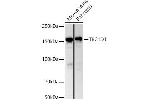 Western blot analysis of extracts of various cell lines, using TBC1D1 antibody (ABIN6129487, ABIN6148878, ABIN6148879 and ABIN6225024) at 1:1000 dilution. (TBC1D1 antibody  (AA 520-710))