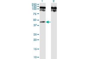 Western Blot analysis of TNFRSF19 expression in transfected 293T cell line by TNFRSF19 monoclonal antibody (M02), clone 1H6.