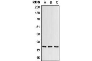 Western blot analysis of GM-CSF expression in THP1 (A), Raw264. (GM-CSF antibody  (C-Term))