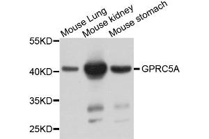Western blot analysis of extract of various cells, using GPRC5A antibody. (GPRC5A antibody)