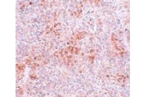 Immunohistochemistry (IHC) image for anti-Bifunctional Apoptosis Regulator (BFAR) (C-Term) antibody (ABIN1030292) (BFAR antibody  (C-Term))