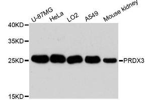 Western blot analysis of extracts of various cell lines, using PRDX3 antibody. (Peroxiredoxin 3 antibody  (AA 63-256))