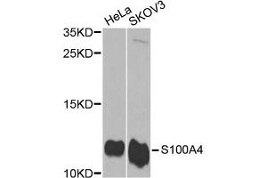 Western blot analysis of extracts of various cell lines, using S100A4 antibody (ABIN5970801) at 1/1000 dilution. (s100a4 antibody)