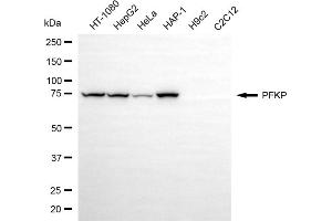 Western blotting analysis using PFKP antibody (ABIN7799803).