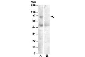 Western blot testing of human ovay lysate with SULF2 antibody at 0. (SULF2 antibody)