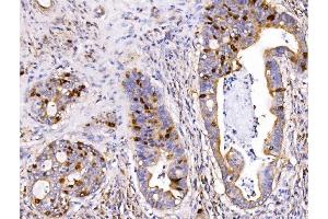IHC analysis of Geminin/GMNN using anti-Geminin/GMNN antibody (ABIN7600598).