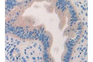DAB staining on IHC-P; Samples: Mouse Uterus Tissue (HYAL1 antibody  (AA 52-462))